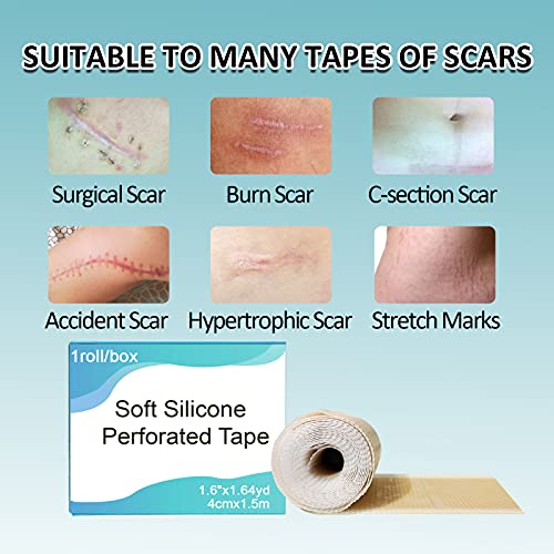 Fanhostco Medical Silicone Scar Tape (1.6” x 60”) - Silicone Strips Gel Tape ...
