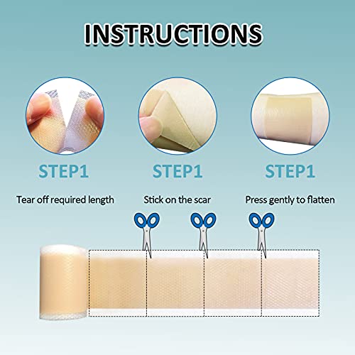 Fanhostco Medical Silicone Scar Tape (1.6” x 60”) - Silicone Strips Gel Tape ...