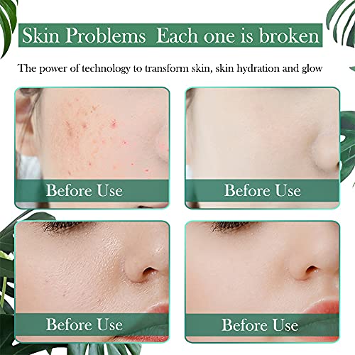 FATUXZ Portable Nano Facial Mister,80ml Cool Mist Facial Handy Mist Sprayer,M...