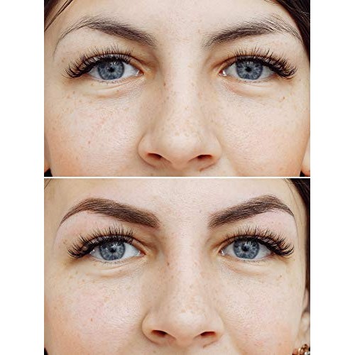 FEG Eyebrow Enhancer Growth Treatment Serum | Eyebrow Enhancing Serum to Help...