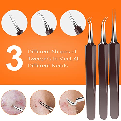 2022 Updated 15 PCS Pimple Popper Tool Kit, Blackhead Remover Comedone Acne E...