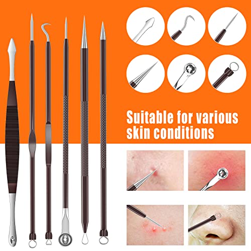 2022 Updated 15 PCS Pimple Popper Tool Kit, Blackhead Remover Comedone Acne E...