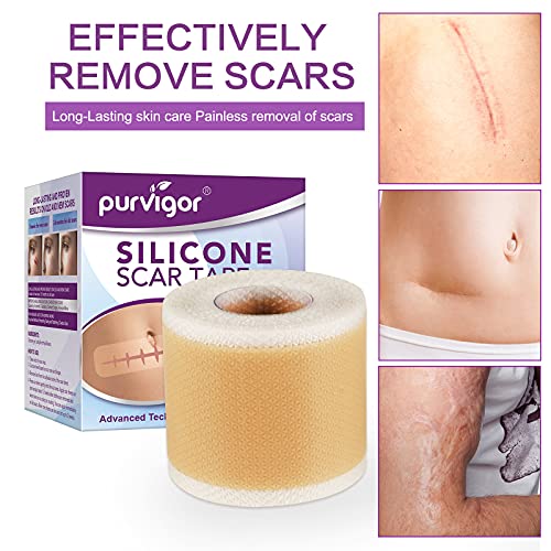 Silicone Scar Tape Roll, 1.6” x 60” Medical Tape for Wound Care Bandages Scar...