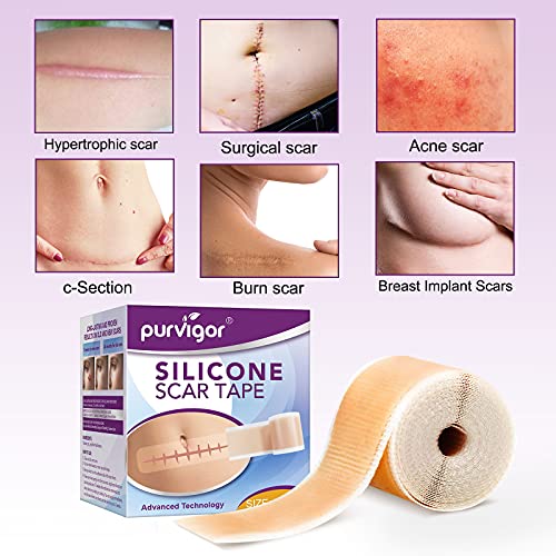 Silicone Scar Tape Roll, 1.6” x 60” Medical Tape for Wound Care Bandages Scar...