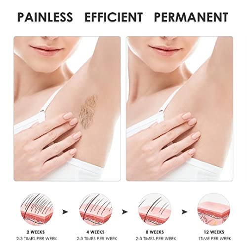 IPL Hair Removal, FIDAC Laser Hair Removal Device for Women & Men with 999,99...