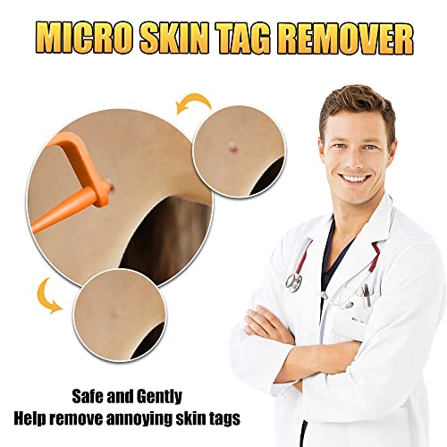 Skin Tag Remover, Micro Skin Tag Removal Kit for Face, Neck, Finger and Body,...