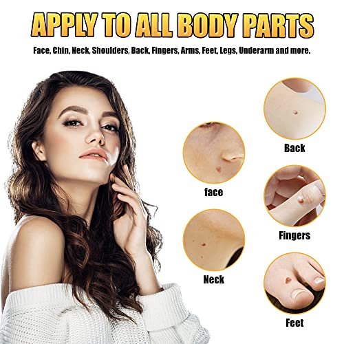 Skin Tag Remover, Micro Skin Tag Removal Kit for Face, Neck, Finger and Body,...