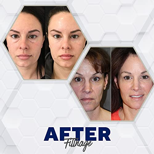 FillHage Facial Rejuvenation Treatment, Anti-Aging Filler Set, Needle-Free, H...