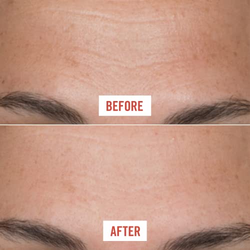 First Aid Beauty Ultra Repair Firming Collagen Cream - Day & Night Anti-Aging...