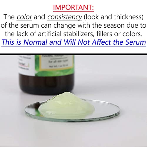 Tree of Life Retinol Serum for Face Wrinkles | Renewing Facial Serum with Bot...