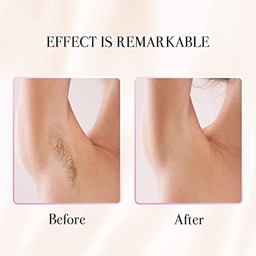 Hair Removal Epilator for Women, Portable Cordless Razor Facial Hair Shaver, ...