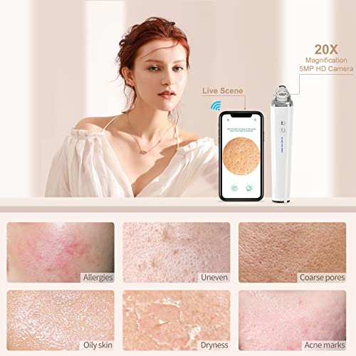 Blackhead Remover Pore Vacuum, WiFi Visual Pore Beauty Device for Skin Care, ...