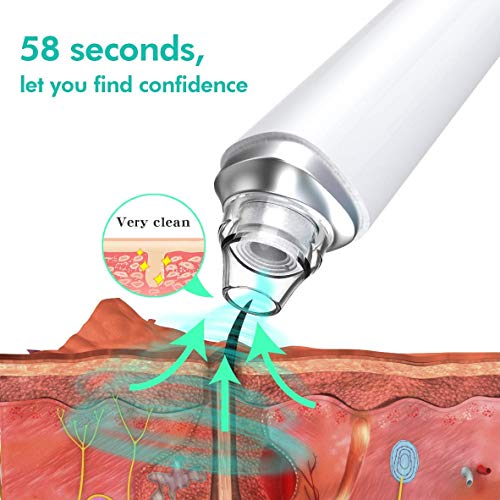 Blackhead Remover Pore Vacuum, WiFi Visual Pore Beauty Device for Skin Care, ...
