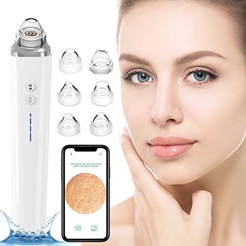 Blackhead Remover Pore Vacuum, WiFi Visual Pore Beauty Device for Skin Care, ...