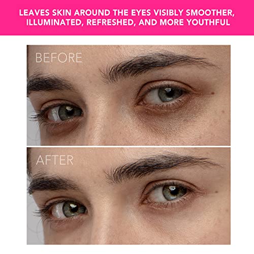 FOREO IRIS Illuminating Eye Massager Magenta, Targets Dark Circles, Puffiness...