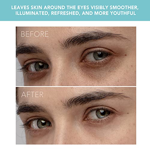 FOREO IRIS Illuminating Eye Massager Mint, Targets Dark Circles, Puffiness, F...