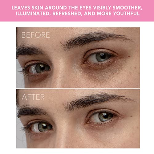 FOREO Iris Illuminating Eye Massager Petal Pink, Targets Dark Circles, Puffin...