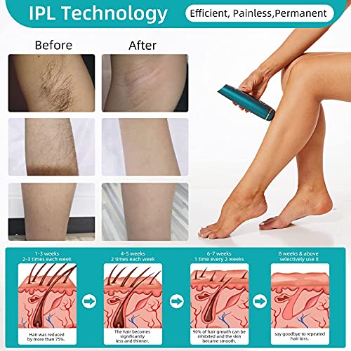 Laser Hair Removal for Women and Men, IPL Permanent Hair Removal with 999,999...