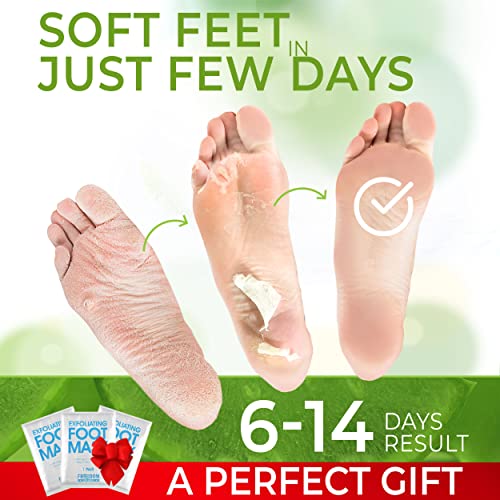 Foot Peel Mask (3 Pack), Foot Mask with Aloe Vera, Exfoliating Baby Foot Peel...