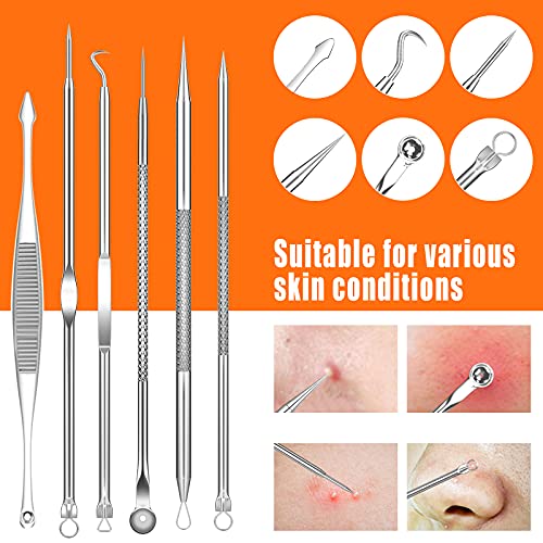 2022 Latest 15 PCS Blackhead Remover Tools, Pimple Popper Tool Kit, Acne Extr...