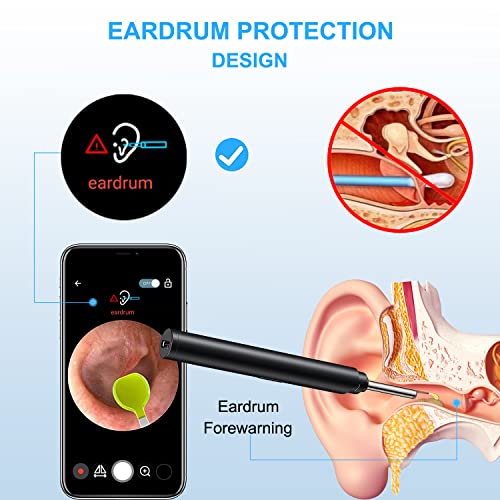 Ear Wax Removal Tool, Ear Cleaner with 1296P Camera, Ear Cleaning Kit with 6 ...