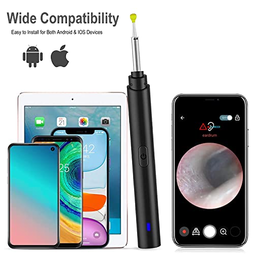 Ear Wax Removal Tool, Ear Cleaner with 1296P Camera, Ear Cleaning Kit with 6 ...