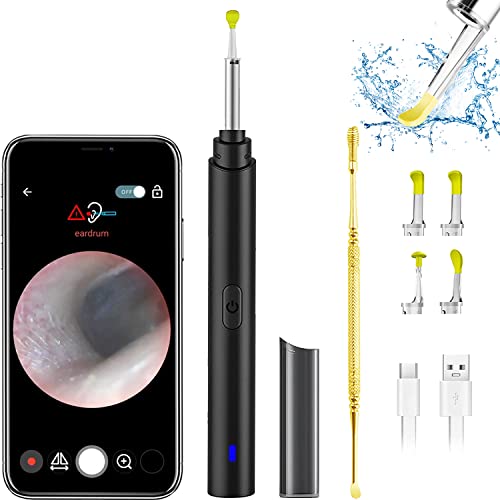 Ear Wax Removal Tool, Ear Cleaner with 1296P Camera, Ear Cleaning Kit with 6 ...