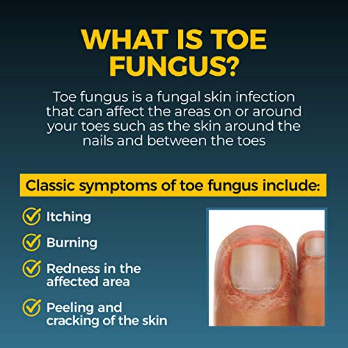 Fungi-Nail Anti-Fungal Liquid Solution , Kills Fungus That Can Lead to Nail &...