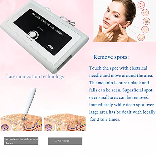 funwill Removal Facial Skin Tag Repair Device ,Multi Speed Level Adjustable B...