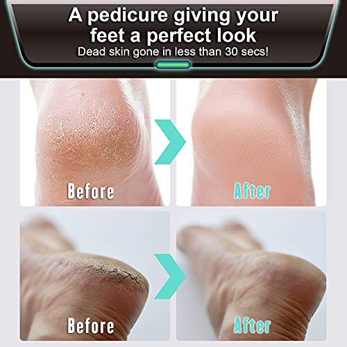 Future Lab. 6S Callus Corn Remover for feet - Electric Feet 2500 RPMs Exfolia...