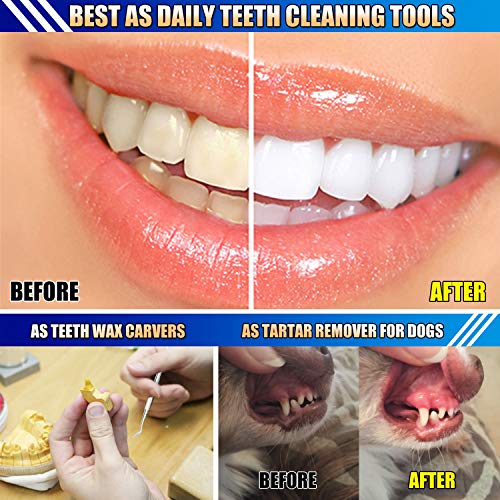 Dental Tools, Plaque Remover for Teeth, Professional Dental Hygiene Cleaning ...