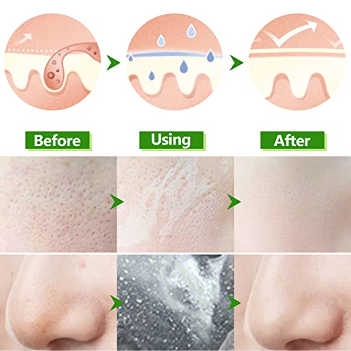 Aloe Vera Peel Off Blackhead Remover Mask - Peel Off Face Masks Whitehead Rem...