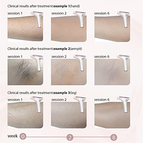 At Home IPL Laser Hair Removal Device for Women Permanent Professional Epilat...