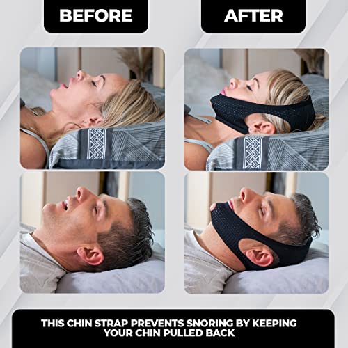 Dysnosis Chin Strap - Chin Strap for Cpap Users - Cpap Chin Strap for Men and...
