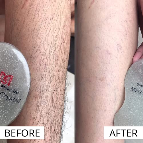 Magic Crystal Painless Hair Remover for Men and Women (New Technology) Fast &...