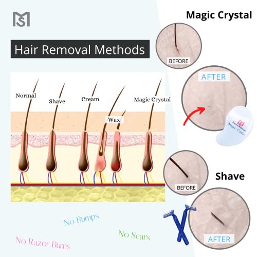 Magic Crystal Painless Hair Remover for Men and Women (New Technology) Fast &...