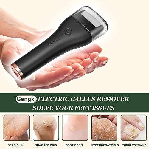Electric Callus Remover for Feet Rechargeable, Professional Feet Callous Remo...