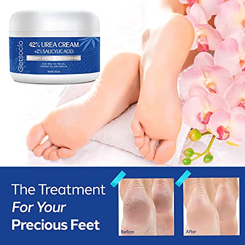 Urea Cream 42% Plus Salicylic Acid 4 Oz, Upgraded Callus Remover Hand Cream F...