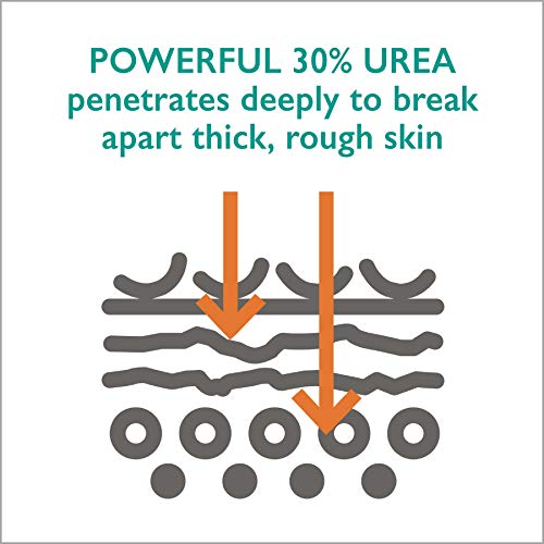 Callus Relief Stick with Powerful 30% Urea - Quick & Easy No-Mess Stick Helps...