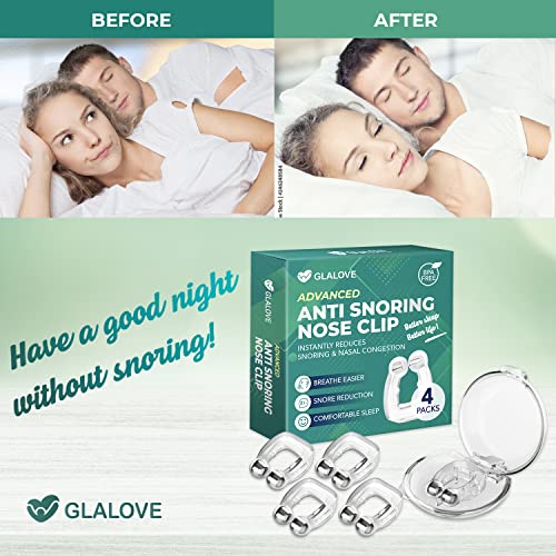 Glalove Anti Snoring Devices - Premium Anti Snoring Nose Clip, Instantly Redu...