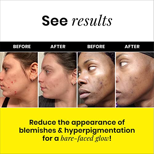 Gleamin Turmeric Vitamin C Clay Mask & Mask Brush - Clay Face Mask with Aloe ...