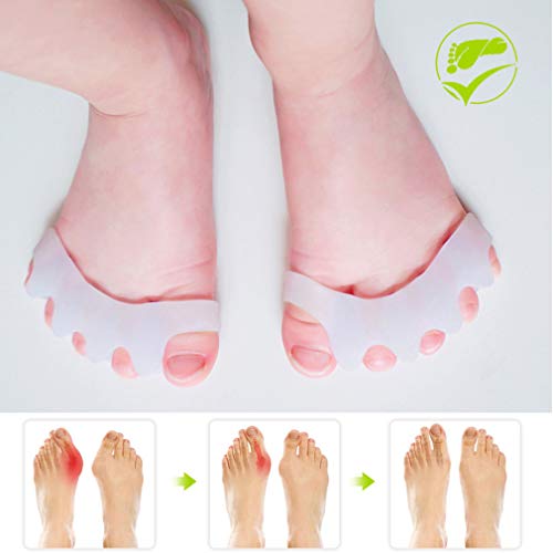 GloDeals Bunion Corrector, 6pcs Kids toe separator Soft Gel Bunion Pad&Spacer...