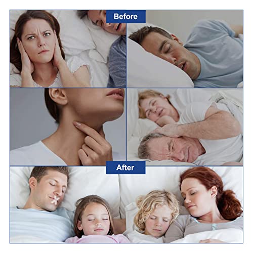 Sleep Strips 120PCS Anti Snoring Gentle Mouth Tape for Nose Breathing Sleepin...