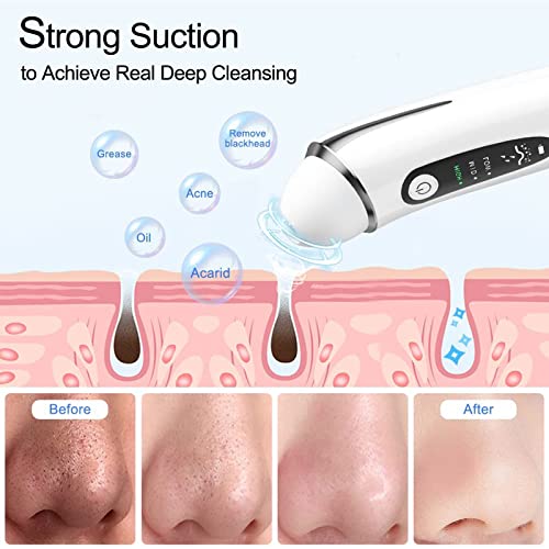 Blackhead Remover Pore Vacuum, 1080P WiFi Visible Facial Pore Ceaner, Skin Ca...