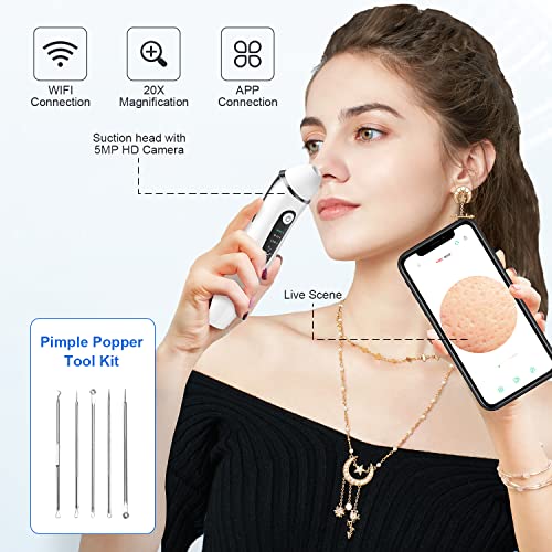 Blackhead Remover Pore Vacuum, 1080P WiFi Visible Facial Pore Ceaner, Skin Ca...