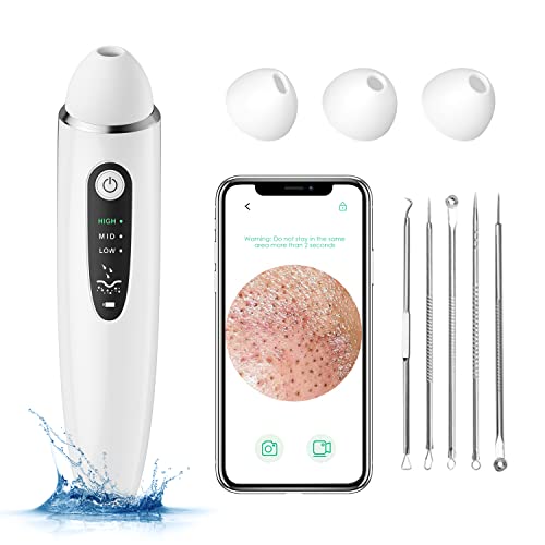 Blackhead Remover Pore Vacuum, 1080P WiFi Visible Facial Pore Ceaner, Skin Ca...