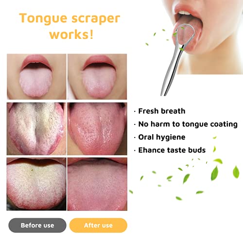 Gohizer 4 Pack Tongue Scraper for Kids and Adults, Great for Oral Care (Medic...