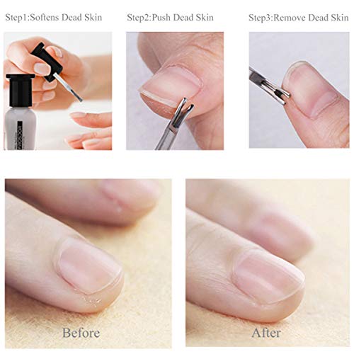 Dead Skin Remover Fork, Gojiny Nail Art Stainless Steel Dead Skin Remover For...