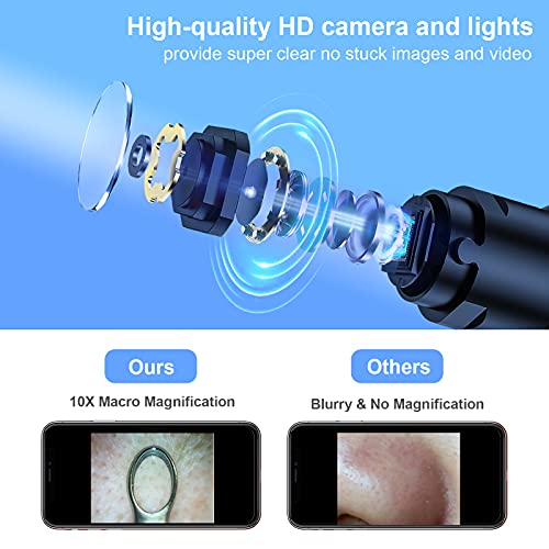 GOODtime Visible Blackhead Remover, Pimple Popper Tool, Pore Cleaner with Ult...