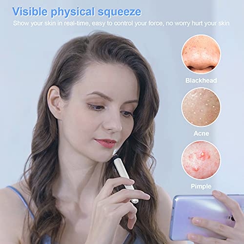 GOODtime Visible Blackhead Remover, Pimple Popper Tool, Pore Cleaner with Ult...